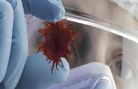 高达90%的癌症患者都死于癌细胞转移？这2味中药帮你提高免疫力，识别“击杀”癌细胞！